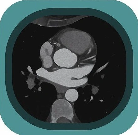 CT Heart anatomy icon